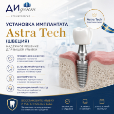Установка имплантата системы Astra Tech (Швеция) c ДЦ коронкой